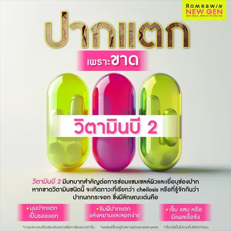 ปากแตก