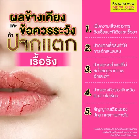 ปากแตก
