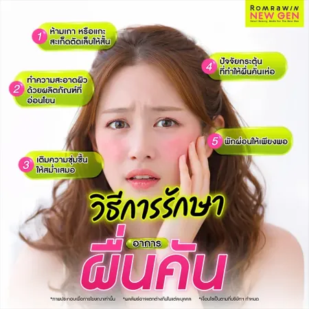 ผื่นคัน