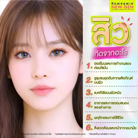 รักษาสิว