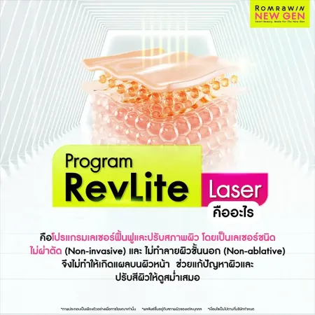 RevLite Laser