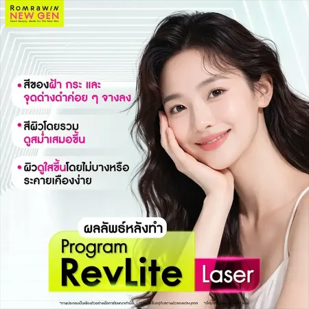 RevLite Laser