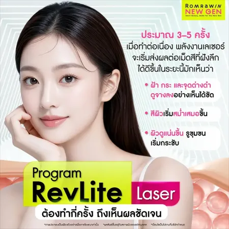 RevLite Laser