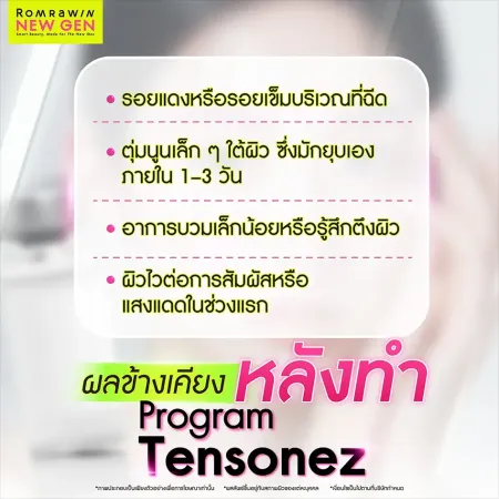 Tensonez