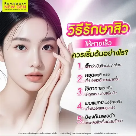 วิธีรักษาสิว