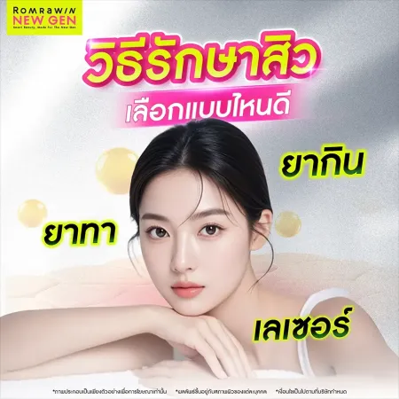 วิธีรักษาสิว