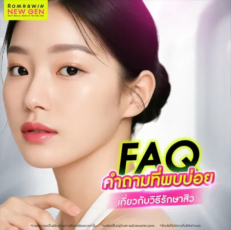 วิธีรักษาสิว