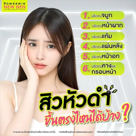 สิวหัวดำขึ้นตรงไหนได้บ้าง 6 ตำแหน่งพบบ่อยและวิธีดูแลโดยแพทย์