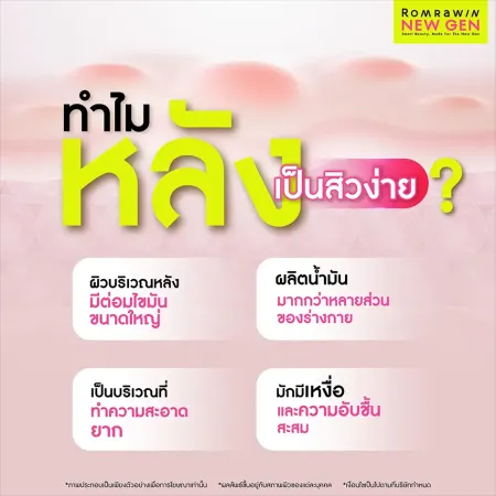 สิวที่หลังเกิดจาก