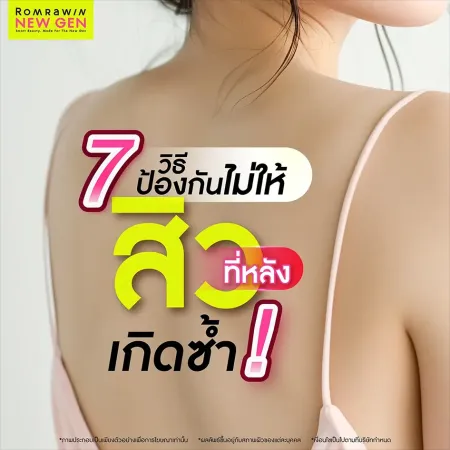 สิวที่หลังเกิดจาก