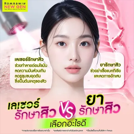 ประเภทสิว