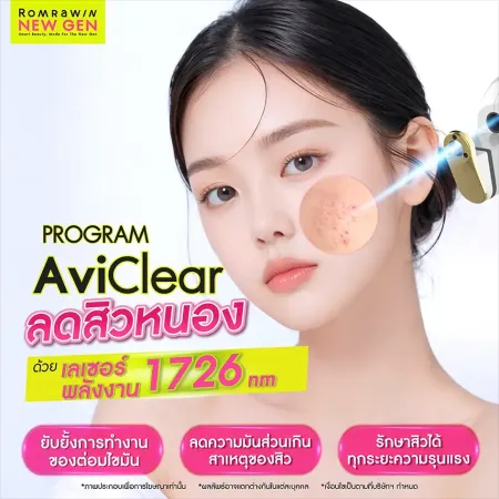 สิวหนอง