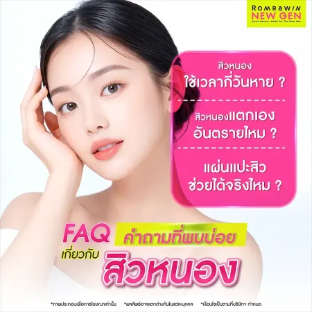 สิวหนอง