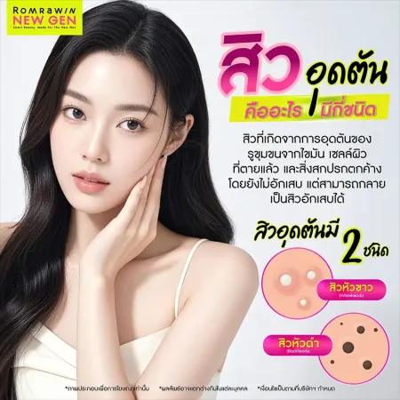สิวมีกี่ประเภท