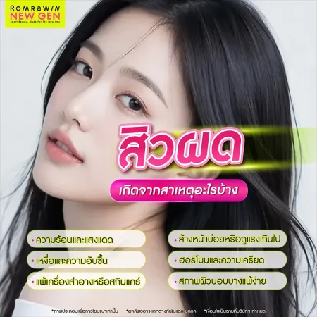 วิธีรักษาสิวผด