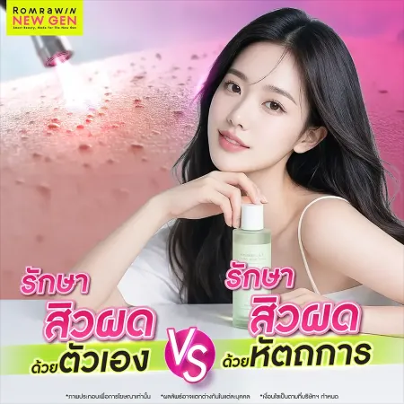 วิธีรักษาสิวผด