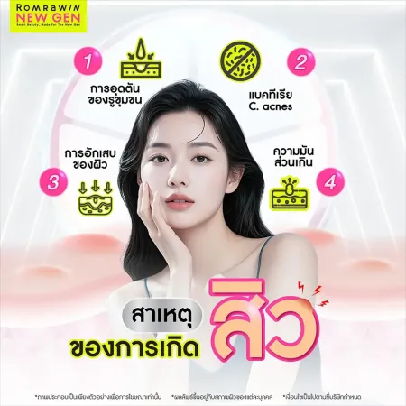 Acne Tune-Up Plus 990