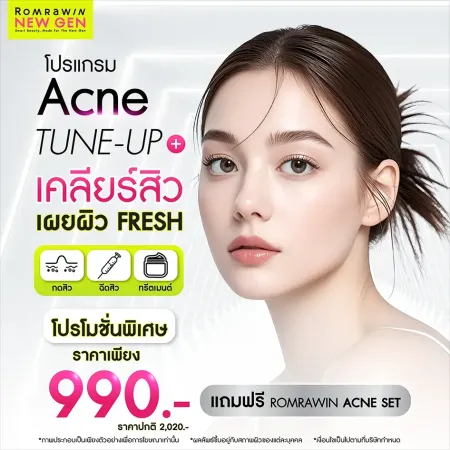 Acne Tune-Up Plus 990