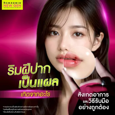 ริมฝีปากเป็นแผล สาเหตุเกิดจากอะไร วิธีสังเกตอาการและป้องกันอย่างไร