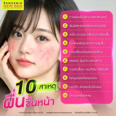 ผื่นขึ้นหน้า