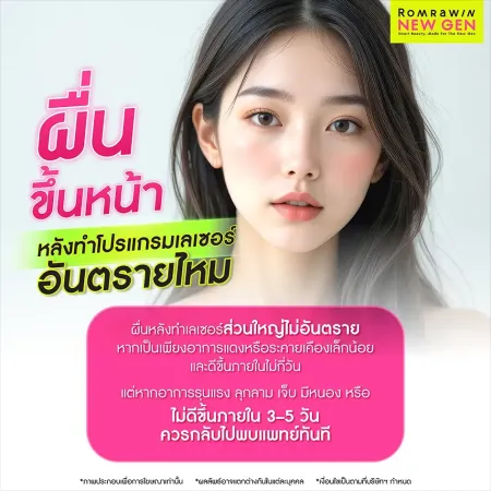 ผื่นขึ้นหน้า