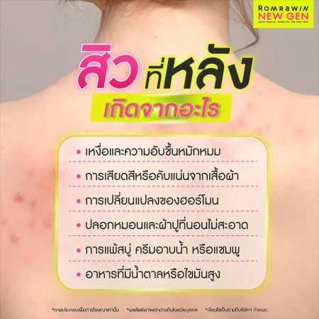 สิวที่หลัง