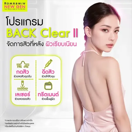 สิวที่หลัง