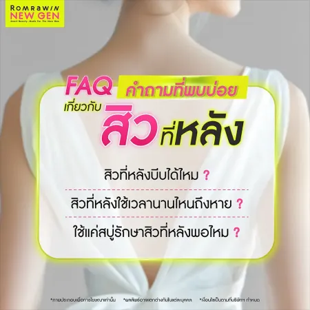 สิวที่หลัง