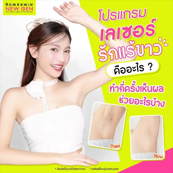 เลเซอร์รักแร้ขาว ช่วยอะไรบ้าง ราคาเท่าไหร่ ทำกี่ครั้งเห็นผล