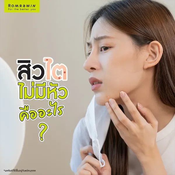สิวไต ไม่มีหัว คืออะไร เกิดจากสาเหตุอะไร รักษาอย่างไร