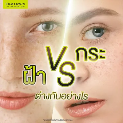 ฝ้ากระ ต่างกันอย่างไร รักษาอย่างไร ให้หน้ากระจ่างใส