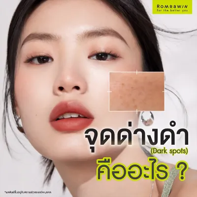 จุดด่างดำคืออะไร เกิดจากอะไร มีวิธีรักษาอย่างไรบ้าง