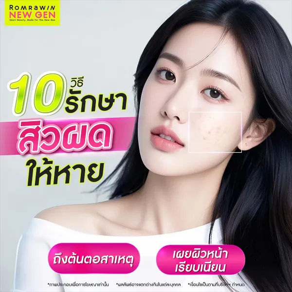 10 วิธีรักษาสิวผด เร่งด่วน กู้หน้าพังให้กลับมาเนียนใสภายใน 7 วัน