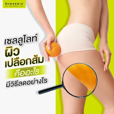 เซลลูไลท์ คืออะไร เกิดจากอะไร มีวิธีกำจัดอย่างไรให้เห็นผล