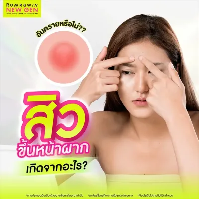 สิวขึ้นหน้าผาก เกิดจากอะไร วิธีรักษาอย่างตรงจุด เหมาะกับใคร