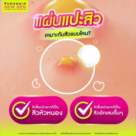 แผ่นแปะสิวเหมาะกับสิวแบบไหน สิวอักเสบสิวหัวหนองโดยแพทย์