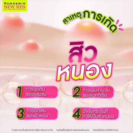 สิวหนองเกิดจาก