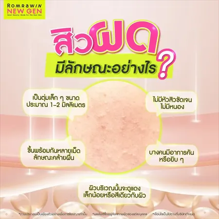 สิวผดเกิดจาก