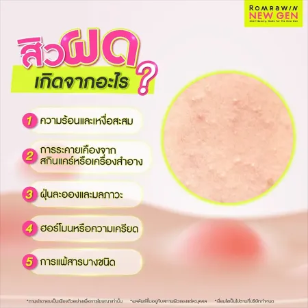 สิวผดเกิดจาก