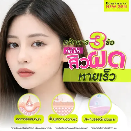 สิวผดเกิดจาก
