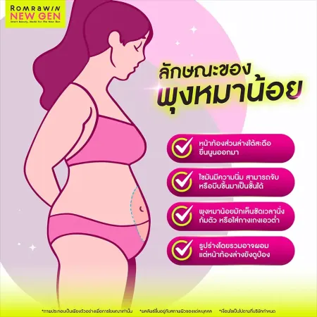 พุงหมาน้อย ภาพกราฟิกอธิบายสี่ลักษณะของหน้าท้องส่วนล่างยื่นนูนที่พบบ่อยในผู้หญิงหุ่นผอม