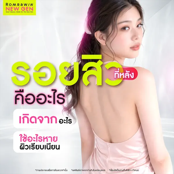 รอยสิวที่หลัง คืออะไร? สาเหตุการเกิดและวิธีรักษาให้หลังเนียนใส