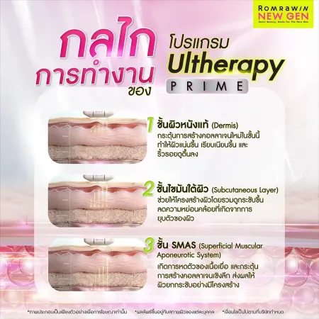 เจาะลึกหลักการและกลไกการทำงานเพื่อยกกระชับชั้นผิวด้วยโปรแกรม Ultherapy Prime รมย์รวินท์คลินิก