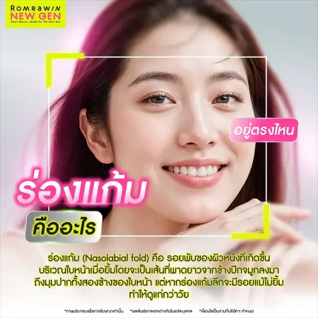 ร่องแก้ม