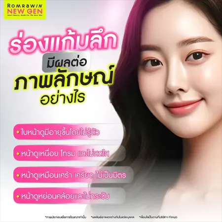 ร่องแก้ม