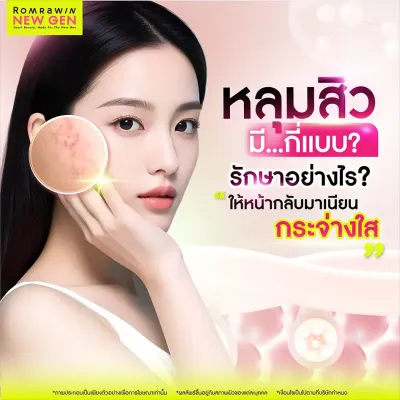 หลุมสิวมีกี่แบบ รักษาอย่างไรให้ตื้นขึ้น ผิวเรียบเนียน