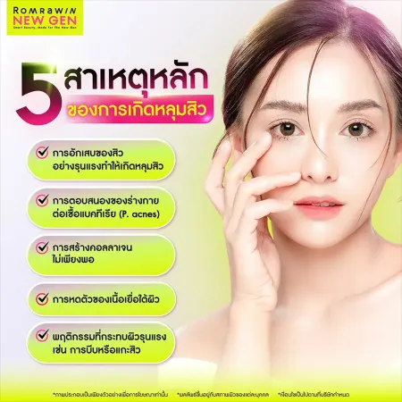 หลุมสิว