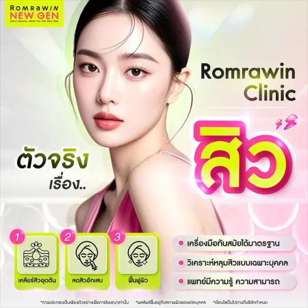 หลุมสิว