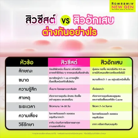 เปรียบเทียบสิวซีสต์กับสิวอักเสบ ทั้งลักษณะ ขนาด ความรุนแรงและวิธีรักษา