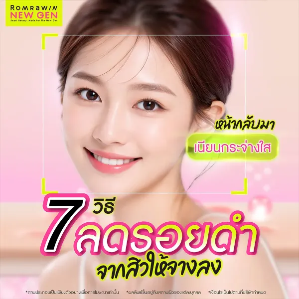 7 วิธีลดรอยดำจากสิวแบบเร่งด่วน เปลี่ยนหน้าหมองให้ใสจริง